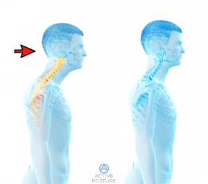 head forward comparison