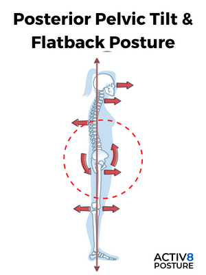 Activ8 Posture posterior pelvic tilt with flatback posture