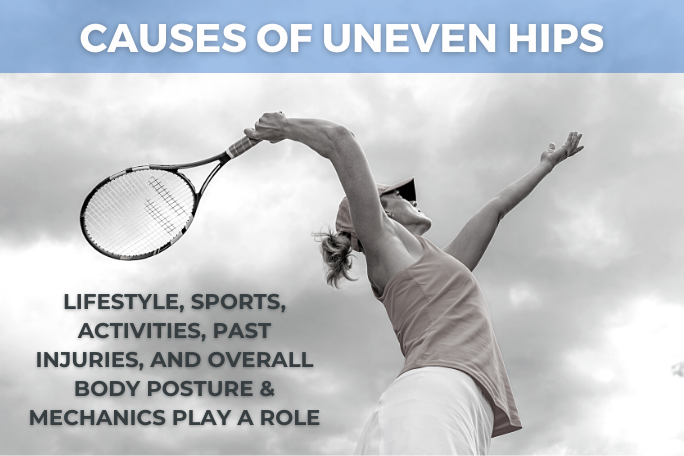 Illustration of one-sided sports, activities and habits that can lead to uneven hips