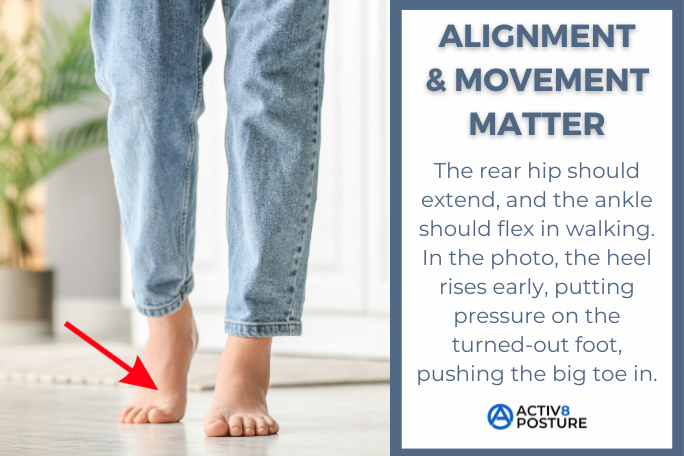 how to prevent bunions from forming