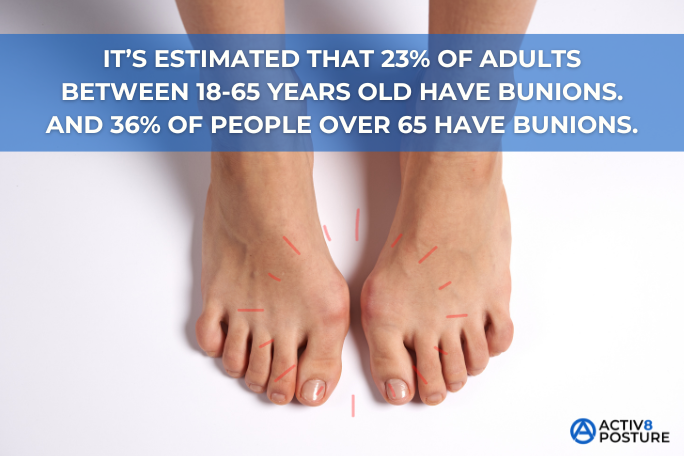 how to prevent bunions