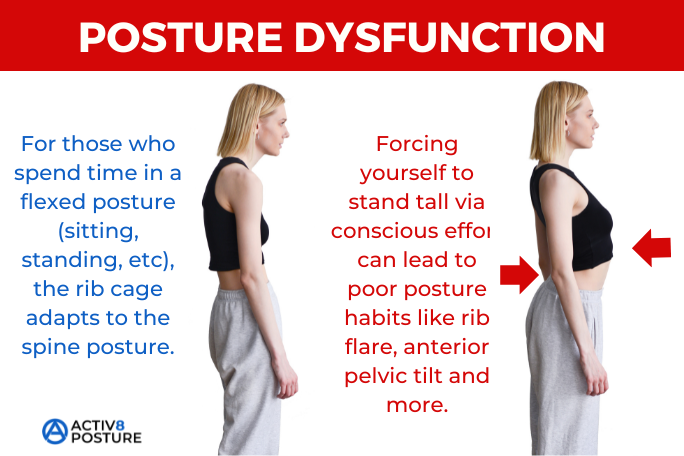 poor posture cause of rib flare condition