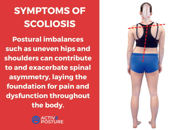 scoliosis pain symptoms