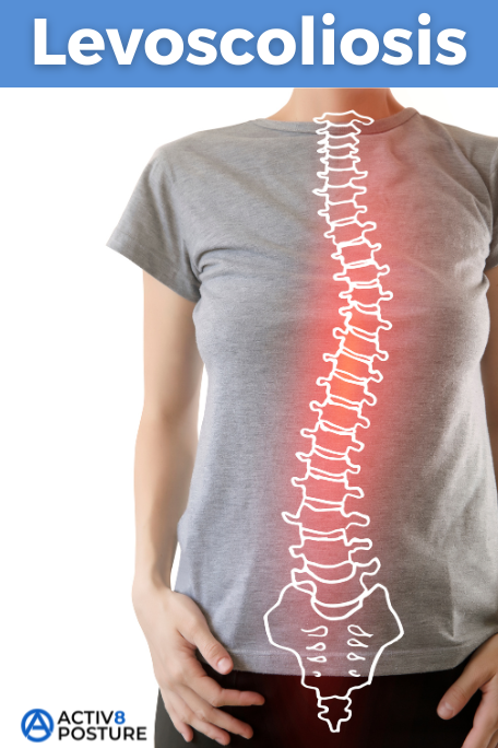 levoscoliosis thoracic levoscoliosis