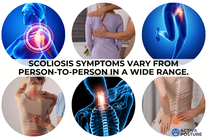 scoliosis-symptoms scoliosis symptoms