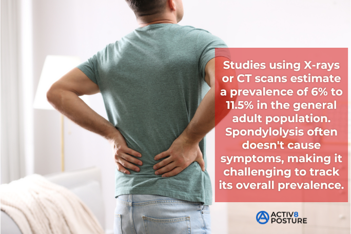 symptoms of spondylolysis