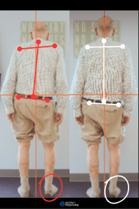 activ8-posture-before-and-after-4