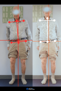 activ8-posture-before-and-after-6