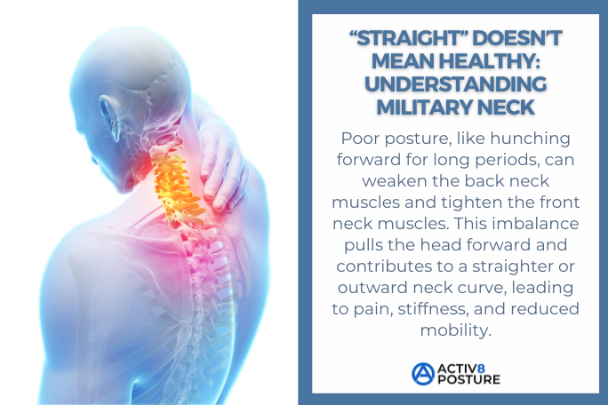 Illustration of common causes of military neck posture